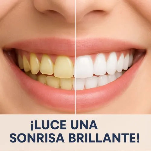 LuxSmile: Blanqueador Dental Avanzado